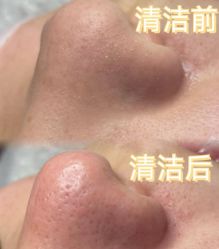 -POCO宝珂丽科技美肤