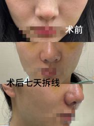 -上海玫瑰医疗美容医院