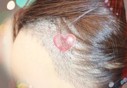 -大麦微针植发全国连锁