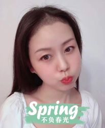 -大麦微针植发全国连锁