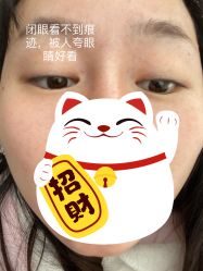 体验后-南京康美美容医院·旗舰店