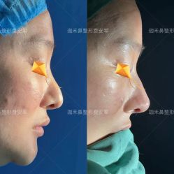 -JustHer宁波珈禾医疗美容医院