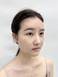点击看大图 体验前-深圳艺星医疗美容医院