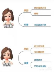 -凡碧诗毛孔清洁收细