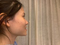 -洁铭新加坡医美