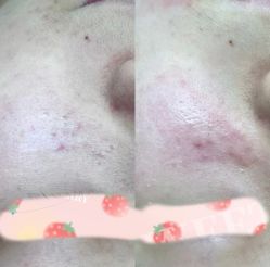 -王妃SPA·美容·科技抗衰
