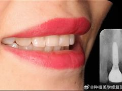 -永信齿科·永恩口腔门诊部(浦东新区店)