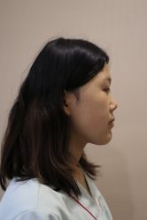 -北京米扬丽格医疗美容·联合丽格鼻整形中心