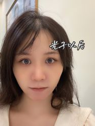 点击看大图 -广州健丽·去眼袋医疗美容机构