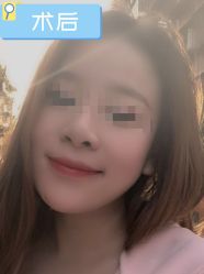 -素美医疗美容·西南眼鼻整形·修复基地