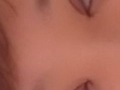 第三天-上海华安整形外科门诊部