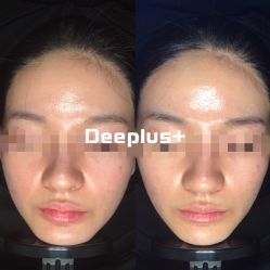 -Deeplus+韩国皮肤管理한국피부관리·C:Lab肌肤实验室