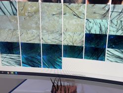 -雍禾植发全国连锁