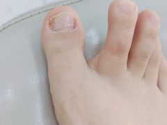 -新甲连锁灰指甲·甲沟炎·鸡眼(黑龙江路店)