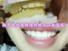 -团圆口腔·种植中心(锦江院区)