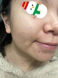 体验后-德媛医疗美容