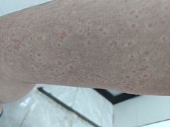 -广西壮族自治区南溪山医院