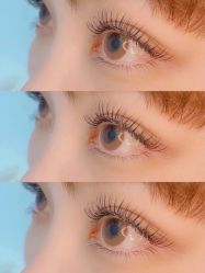 -美肤盾祛痘·问题肌头疗管理中心