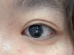 -苏州大学理想眼科医院