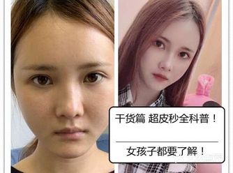 如果是其他需求，建议 3 个月或者 1