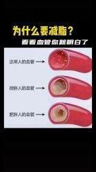 -莫纳瑜伽·普拉提