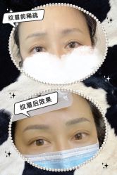 点击看大图 -MIVI半永久纹眉机器野生眉纹唇