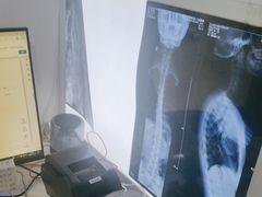 -张钰强中医正骨推拿连锁(华发商都店)