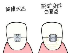 -团圆口腔·种植中心(锦江院区)