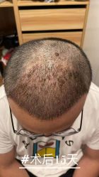 -雍禾植发全国连锁