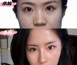 -深圳艺星医疗美容医院