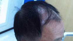 -雍禾植发全国连锁