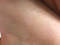 -大韩庄韩氏祖传正骨