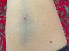 -中国人民解放军总医院