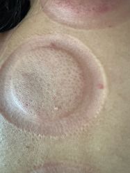 -寇氏减肥