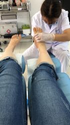 -派恩宜灰指甲鸡眼嵌甲手足癣