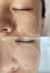 点击看大图 -E.beauty驻颜·痘敏肌调理中心