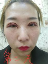 体验后-新美荟医美·专注面部美学抗衰