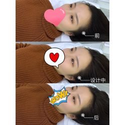 -OnFaer.纹眉半永久无创洗眉