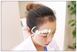 体验后-大麦微针植发全国连锁