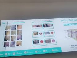 点击看大图 -友仟痘医生科学祛痘连锁