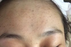 体验后-坤如玛丽·医疗美容中心