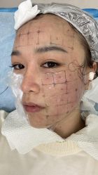 -上海伊莱美医疗美容医院