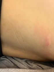 -成都苗方清颜专业祛痘