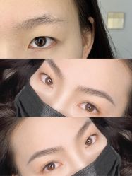 点击看大图 -杨益美学·野生眉半永久纹眉发际线