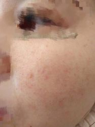-溢美美颜机构