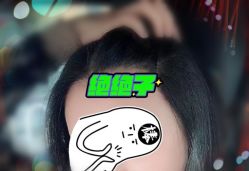 -大麦微针植发全国连锁