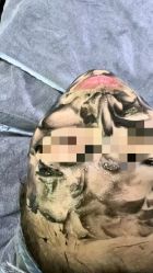 -SKIN79皮肤管理中心