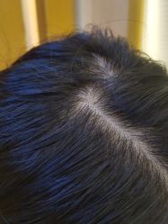 -熙朵美学植发·连锁品牌