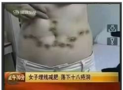 -香薇妮丝·定制减肥·身材管理