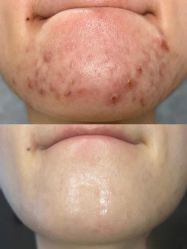 -美愈美肤MEIYU SKIN